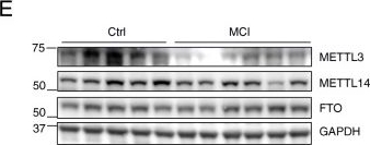 Fig.2.E showing Western Blotting in a Mus musculus (House mouse) sample from the publication: METTL3-dependent RNA m6A dysregulation contributes to neurodegeneration in Alzheimer's disease through aberrant cell cycle events.