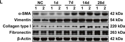 Fig.1.L showing Western Blotting from the publication: Wnt5b/FZD1/LRP6 signaling drives renal fibrosis by triggering cytoplasmic stabilization and nuclear translocation of β-catenin under hypoxia.