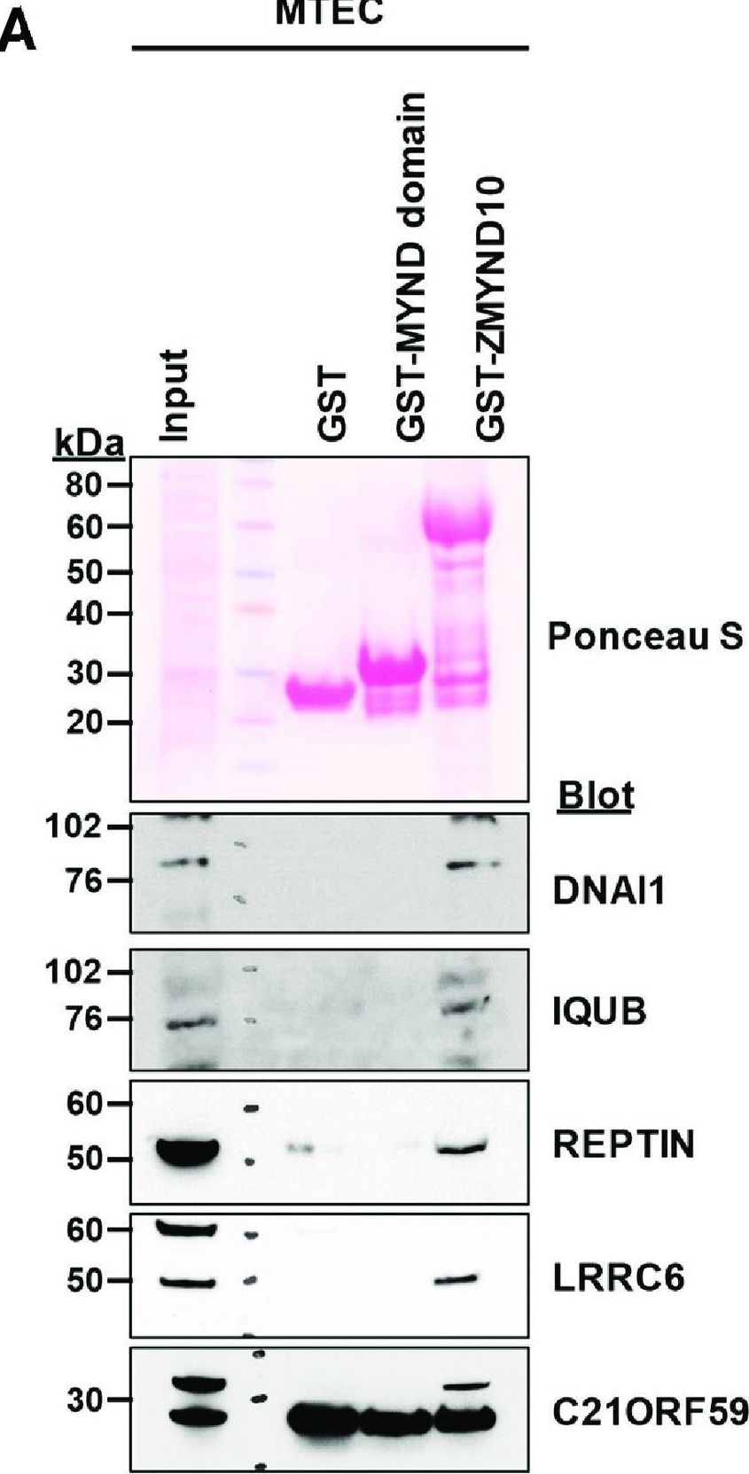 Fig.4.A showing Western Blotting in an Oryctolagus cuniculus (Rabbit) sample from the publication: ZMYND10 stabilizes intermediate chain proteins in the cytoplasmic pre-assembly of dynein arms.