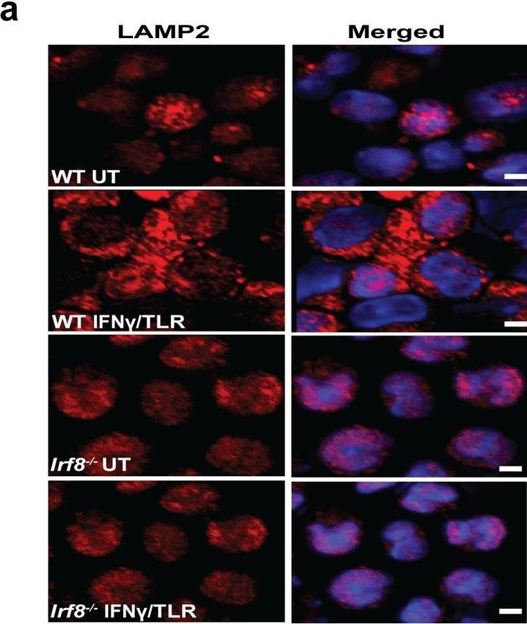 Fig.4.A showing Immunocytochemistry-immunofluorescence from the publication: IRF8 directs stress-induced autophagy in macrophages and promotes clearance of Listeria monocytogenes.