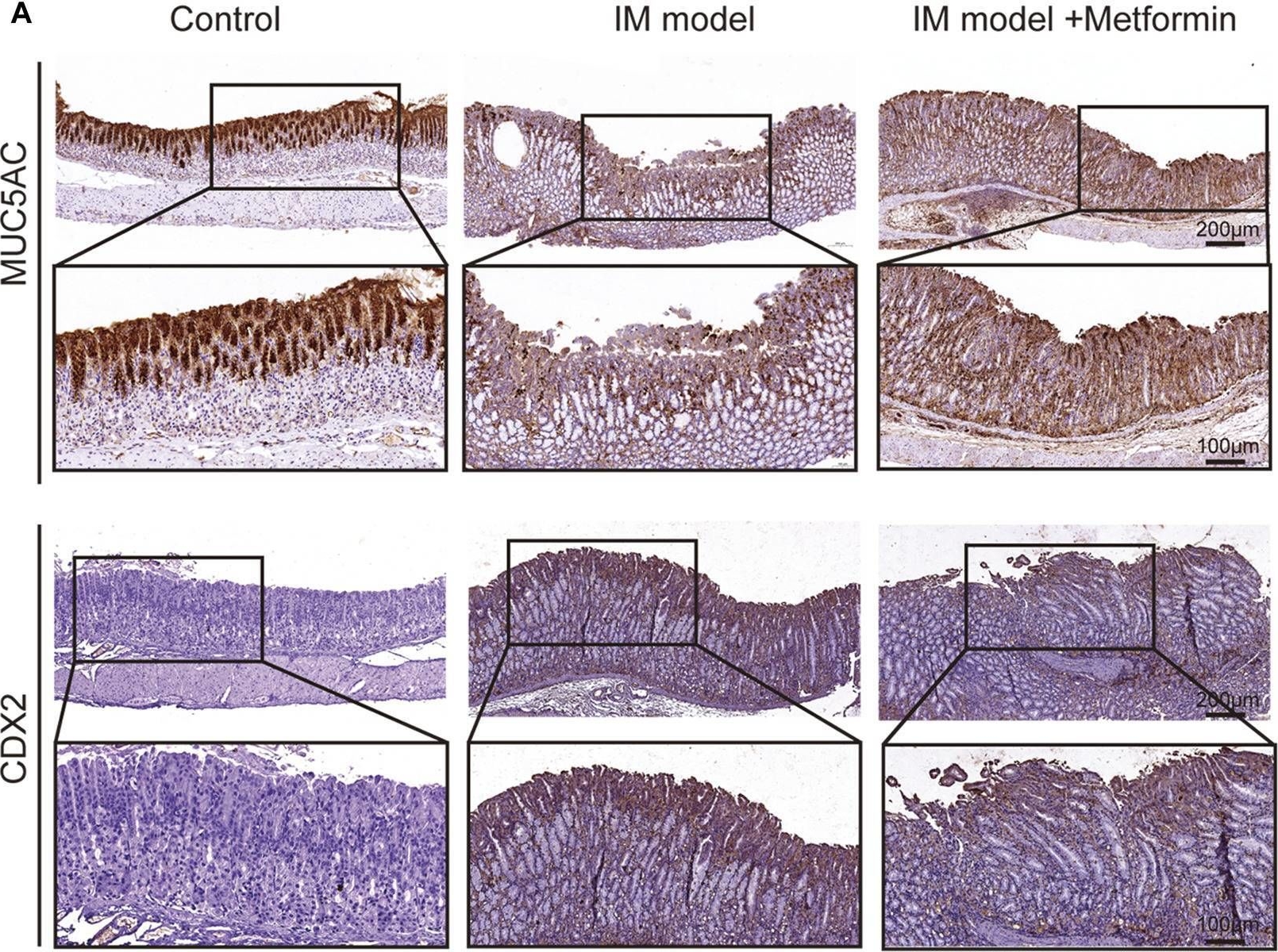 Fig.8.A showing Immunohistochemistry in a Mus musculus (House mouse) sample from the publication: Revealing the role of metformin in gastric intestinal metaplasia treatment.