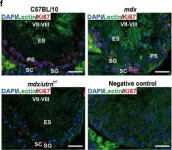 Fig.7.F showing Immunohistochemistry-immunofluorescence in a Mus musculus (House mouse) sample from the publication: Utrophin Compensates dystrophin Loss during Mouse Spermatogenesis.