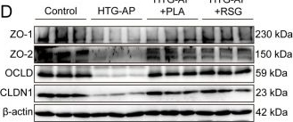 Fig.7.D showing Western Blotting in a Mus musculus (House mouse) sample from the publication: Phenyllactic Acid Restores Intestinal Epithelial Barrier to Alleviate Hypertriglyceridemic Acute Pancreatitis via a PPARγ-Dependent Mechanism.