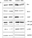 Fig.6.A showing Western Blotting in a Homo sapiens (Human) sample from the publication: A human ribonuclease induces apoptosis associated with p21WAF1/CIP1 induction and JNK inactivation.