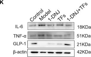 Fig.2.K showing Western Blotting from the publication: 1-Deoxynojirimycin with theaflavins ameliorates high-fat diet-induced insulin resistance in mice by modulating the gut microbiota.