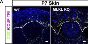 Fig.4.A showing Immunohistochemistry-immunofluorescence in a Mus musculus (House mouse) sample from the publication: Evidence for developmental vascular-associated necroptosis and its contribution to venous-lymphatic endothelial differentiation.