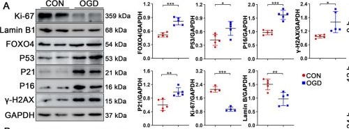 Fig.3.A showing Western Blotting from the publication: FOXO4-DRI regulates endothelial cell senescence via the P53 signaling pathway.