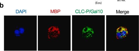 Fig.4.B showing Immunocytochemistry-immunofluorescence from the publication: The impact of Charcot-Leyden Crystal protein on mesothelioma chemotherapy: targeting eosinophils for enhanced chemosensitivity.