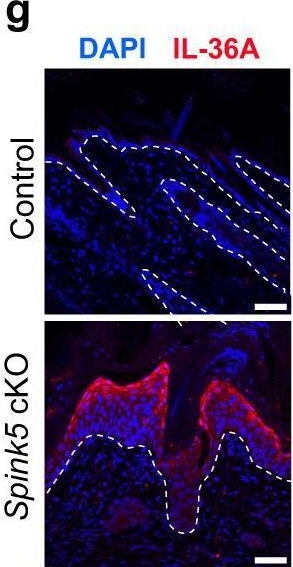 Fig.6.G showing Immunohistochemistry-immunofluorescence in a Mus musculus (House mouse) sample from the publication: Comparative analyses of Netherton syndrome patients and Spink5 conditional knock-out mice uncover disease-relevant pathways.
