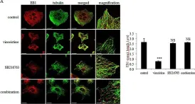 Fig.6.A showing Immunocytochemistry-immunofluorescence from the publication: ROS-mediated EB1 phosphorylation through Akt/GSK3β pathway: implication in cancer cell response to microtubule-targeting agents.
