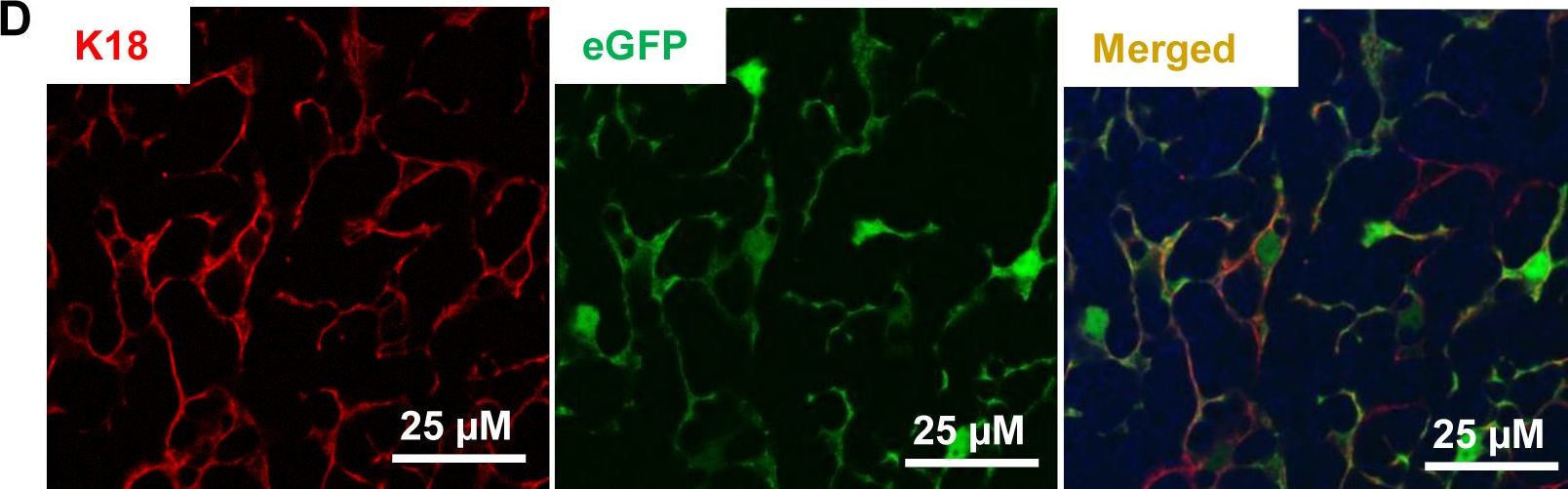 RB inactivation in keratin 18 positive thymic epithelial cells promotes non-cell autonomous T cell hyperproliferation in genetically engineered mice.