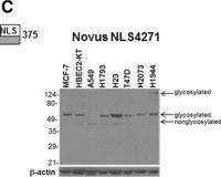 Fig.1.C showing Western Blotting in a Homo sapiens (Human) sample from the publication: Enhanced expression of G-protein coupled estrogen receptor (GPER/GPR30) in lung cancer.