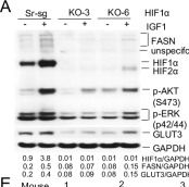 Fig.4.A showing Western Blotting in a Mus musculus (House mouse) sample from the publication: HIF-1α integrates lipogenic FASN and glycolytic GLUT3 to overcome intratumor oxidative and hypoxic stress for colorectal cancer metastasis.