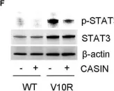 Fig.4.F showing Western Blotting from the publication: Rational Targeting of Cdc42 Overcomes Drug Resistance of Multiple Myeloma.
