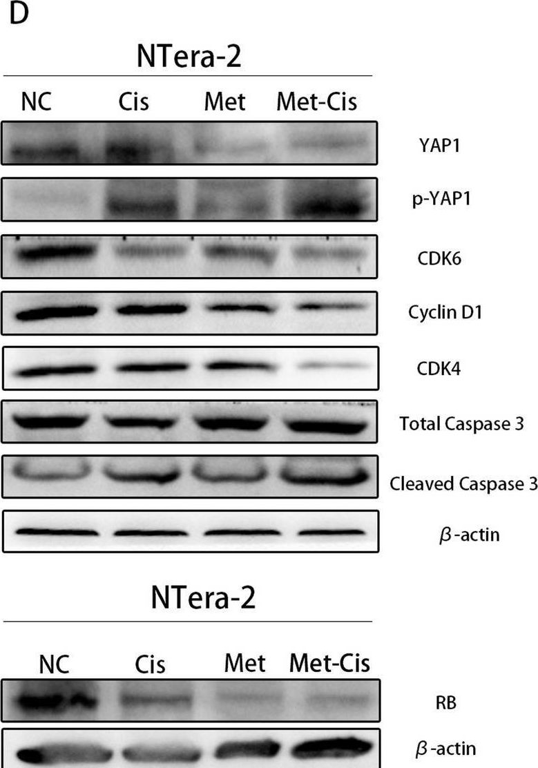 Fig.5.D showing Western Blotting in a Mus musculus (House mouse) sample from the publication: Novel sequential therapy with metformin enhances the effects of cisplatin in testicular germ cell tumours via YAP1 signalling.