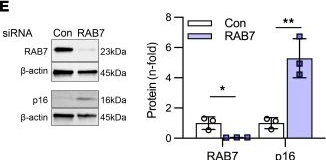 Fig.4.E showing Western Blotting from the publication: RAB7 deficiency impairs pulmonary artery endothelial function and promotes pulmonary hypertension.