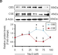 Fig.1.D showing Western Blotting in a Mus musculus (House mouse) sample from the publication: H2S and homocysteine control a novel feedback regulation of cystathionine beta synthase and cystathionine gamma lyase in cardiomyocytes.