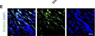 Fig.3.E showing Immunohistochemistry-immunofluorescence in a Homo sapiens (Human) sample from the publication: The landscape of cell regulatory and communication networks in the human dental follicle.
