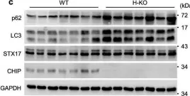 Fig.3.C showing Western Blotting from the publication: CHIP ameliorates nonalcoholic fatty liver disease via promoting K63- and K27-linked STX17 ubiquitination to facilitate autophagosome-lysosome fusion.