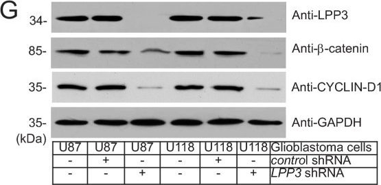 Fig.3.G showing Western Blotting in a Homo sapiens (Human) sample from the publication: Lipid phosphate phosphatase-3 regulates tumor growth via β-catenin and CYCLIN-D1 signaling.