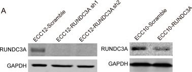 Fig.8.A showing Western Blotting from the publication: RUNDC3A regulates SNAP25-mediated chemotherapy resistance by binding AKT in gastric neuroendocrine carcinoma (GNEC).