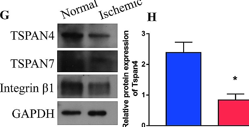 Fig.3.G showing Western Blotting in a Mus musculus (House mouse) sample from the publication: Migrasomes from adipose derived stem cells enrich CXCL12 to recruit stem cells via CXCR4/RhoA for a positive feedback loop mediating soft tissue regeneration.