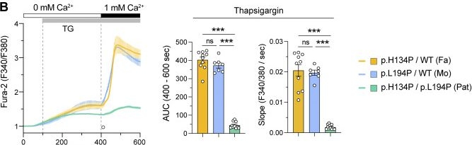 Fig.3.B from the publication: ORAI1 mutation with mixed loss and gain of function properties causes immunodeficiency and HLH.