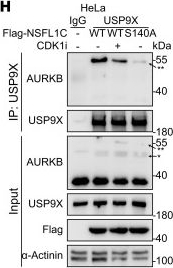 Fig.5.H showing Western Blotting from the publication: PP2A inhibition causes synthetic lethality in BRCA2-mutated prostate cancer models via spindle assembly checkpoint reactivation.