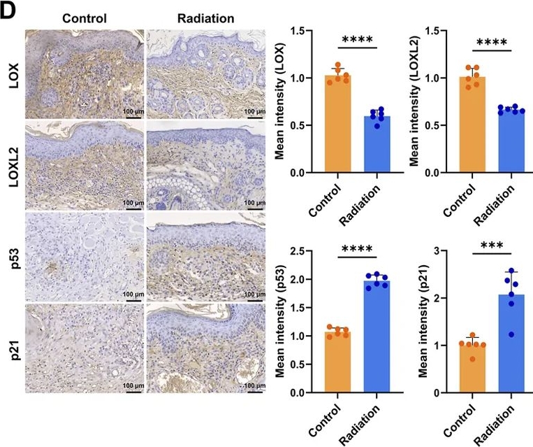 Fig.7.D showing Immunohistochemistry in an Oryctolagus cuniculus (Rabbit) sample from the publication: Mechanistic insights into Strontium-90 superficial radiotherapy in keloids: senescence-associated changes and ECM remodeling across cell-matrix scales.