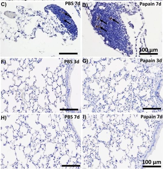 Fig.4.C showing Immunohistochemistry from the publication: Possible Crosstalk of the Immune Cells within the Lung and Mediastinal Fat-Associated Lymphoid Clusters in the Acute Inflammatory Lung Asthma-Like Mouse Model.