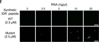 Fig.4.F showing Immunocytochemistry-immunofluorescence from the publication: Aberrant phase separation and nucleolar dysfunction in rare genetic diseases.