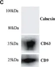Fig.2.C showing Western Blotting from the publication: Priming Astrocytes With HIV-Induced Reactive Oxygen Species Enhances Their Trypanosoma cruzi Infection.