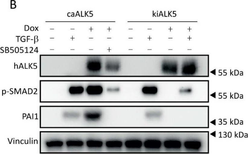 Fig.1.B showing Western Blotting from the publication: TGF-β Type I Receptor Signaling in Melanoma Liver Metastases Increases Metastatic Outgrowth.