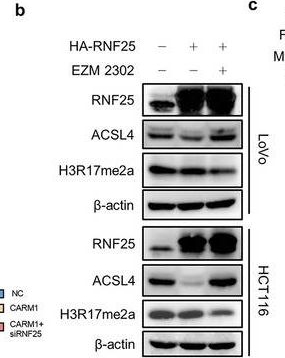 Fig.7.B showing Western Blotting in a Homo sapiens (Human) sample from the publication: Inhibition of CARM1-Mediated Methylation of ACSL4 Promotes Ferroptosis in Colorectal Cancer.