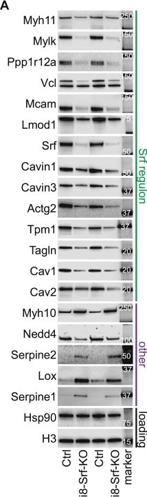 Fig.5.A showing Western Blotting from the publication: Declining activity of serum response factor in aging aorta in relation to aneurysm progression.