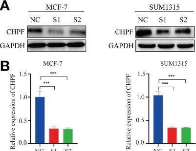 Fig.5.A showing Western Blotting from the publication: Bioinformatics and Experimental Analysis of the Prognostic and Predictive Value of the CHPF Gene on Breast Cancer.
