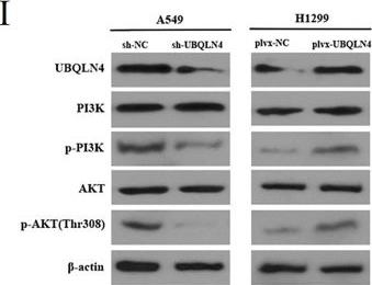 Fig.5.I showing Western Blotting from the publication: UBQLN4 promotes the proliferation and invasion of non-small cell lung cancer cell by regulating PI3K/AKT pathway.
