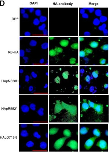 Fig.1.D showing Immunocytochemistry-immunofluorescence in a Homo sapiens (Human) sample from the publication: Analysis of pathogenic variants in retinoblastoma reveals a potential gain of function mutation.