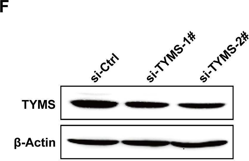 Fig.11.F showing Western Blotting in a Homo sapiens (Human) sample from the publication: Revealing the significance of tissue-resident memory T cells in lung adenocarcinoma through bioinformatic analysis and experimental validation.