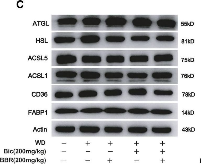 Fig.3.C showing Western Blotting in a Mus musculus (House mouse) sample from the publication: Combined Use of Bicyclol and Berberine Alleviates Mouse Nonalcoholic Fatty Liver Disease.
