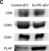 Fig.1.C showing Western Blotting from the publication: LIMCH1-enriched extracellular vesicles promote vascular permeability in early-onset preeclampsia.