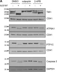 Fig.6.A showing Western Blotting in a Homo sapiens (Human) sample from the publication: 2-Aminoethoxydiphenylborate (2-APB) inhibits release of phosphatidylserine-exposing extracellular vesicles from platelets.