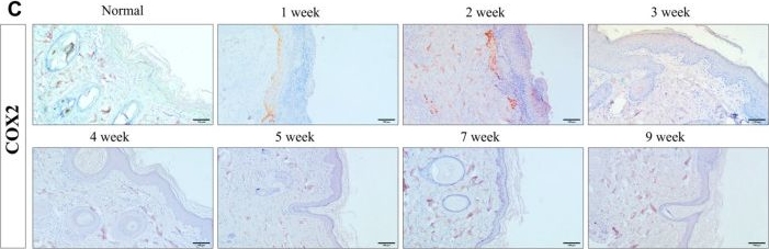 Fig.4.C showing Immunohistochemistry in a Canis lupus familiaris (Domestic dog) sample from the publication: Histological and Molecular Biological Changes in Canine Skin Following Acute Radiation Therapy-Induced Skin Injury.