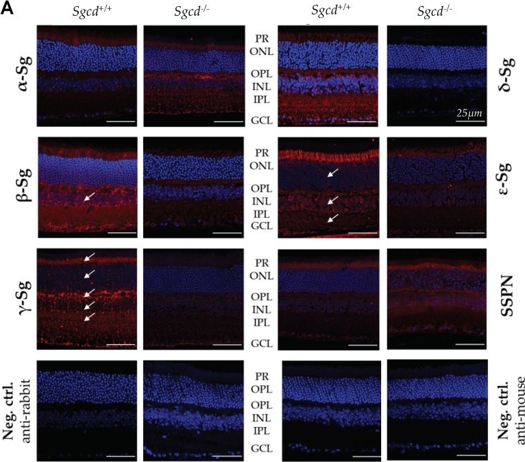 Fig.2.A showing Immunohistochemistry-immunofluorescence in a Mus musculus (House mouse) sample from the publication: Lack of Delta-Sarcoglycan (Sgcd) Results in Retinal Degeneration.