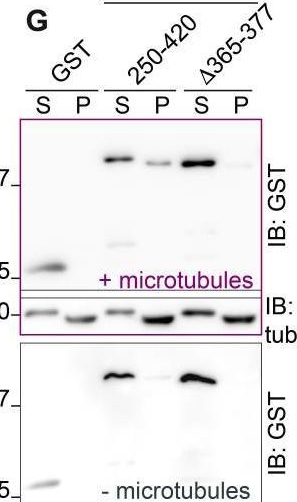 Fig.1.G showing Western Blotting in a Homo sapiens (Human) sample from the publication: Evidence for an interaction of paracingulin with microtubules.