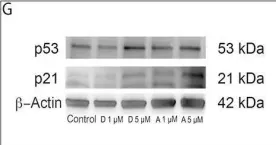 Fig.5.G showing Western Blotting in a Homo sapiens (Human) sample from the publication: Anti-cancer stem cell activity of a sesquiterpene lactone isolated from Ambrosia arborescens and of a synthetic derivative.