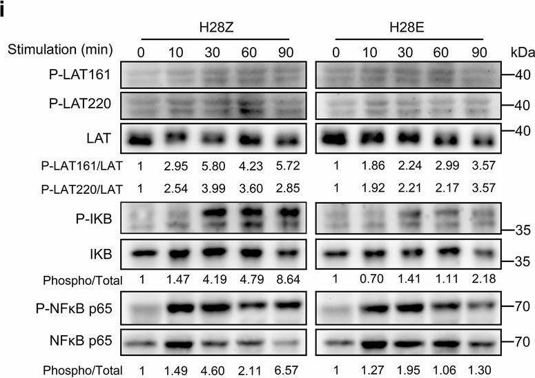 Fig.3.I showing Western Blotting in a Homo sapiens (Human) sample from the publication: Chimeric antigen receptor with novel intracellular modules improves antitumor performance of T cells.