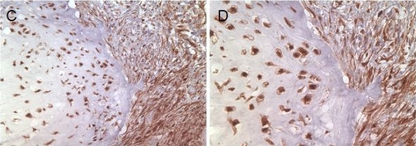 Fig.1.C,D showing Western Blotting in a Homo sapiens (Human) sample from the publication: The antiapoptotic gene survivin is highly expressed in human chondrosarcoma and promotes drug resistance in chondrosarcoma cells in vitro.