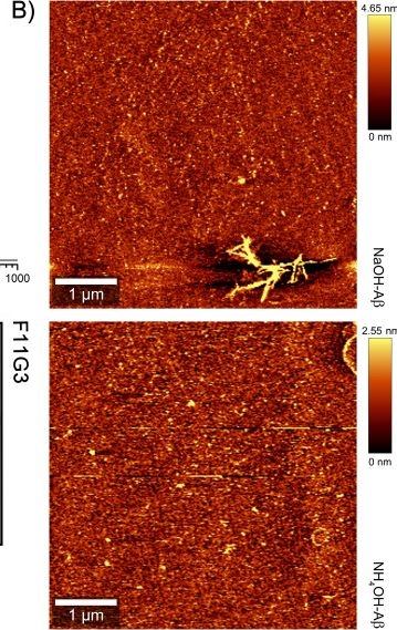 Fig.1.B showing Immunohistochemistry-immunofluorescence in a Homo sapiens (Human) sample from the publication: Different amyloid β42 preparations induce different cell death pathways in the model of SH-SY5Y neuroblastoma cells.
