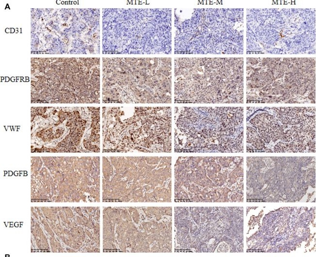 Fig.5.A showing Immunohistochemistry in a Mus musculus (House mouse) sample from the publication: Extract of Marsdenia tenacissima (Roxb.) Moon [Apocynaceae] Suppresses Hepatocellular Carcinoma by Inhibiting Angiogenesis.